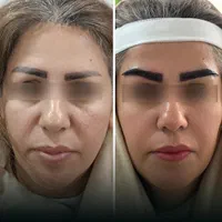 کلینیک تخصصی پوست، مو و زیبایی پارسامهر|خدمات آرایشگری و زیبایی|تهران, امیریه|دیوار