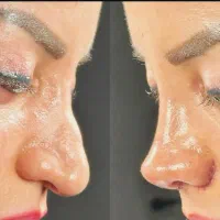 عمل بینی با ما