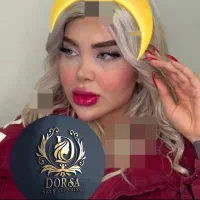 تزریق تخصصی ژل بوتاکس مادلینگ خلیجی هایفو کلینیک