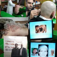زالو درمانی حجامت فصد خون  ساختمان پزشکان ماندگار