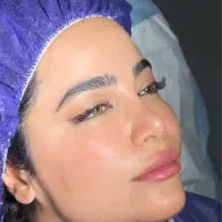 جشنواره ساکشن غبغب توسط فوق تخصص جراح پلاستیک