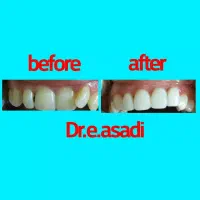 دندانپزشکی و زیبایی لبخند، تعرفه دولتی|خدمات آرایشگری و زیبایی|تهران, جمالزاده|دیوار