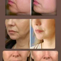 کرم 5 کاره|آرایشی، بهداشتی، درمانی|شیراز, میانرود|دیوار