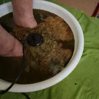 سم زادایی و یون تراپی