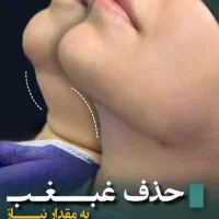 تولید محتوا پست و استوری ویدیو عکس شبکه اجتماعی