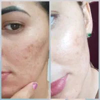 کافیه مشکلت رو بگی و بدون بازگشت نمایندگی محصولات