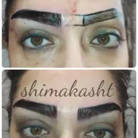کاشت ابروی طبیعی و دائمی توسط تیم پزشکی|خدمات آرایشگری و زیبایی|تهران, زعفرانیه|دیوار