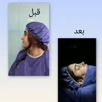 جشنواره تخفیف عمل بینی در تهران تا پایان مهر|خدمات زیبایی و سلامت|تهران, خواجه نصیر طوسی|دیوار