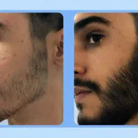 این روغنو بزنی در میاد