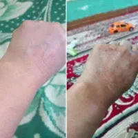 کرم معجزه vip سفیدکننده،از بین برنده لک،کک و مک|آرایشی، بهداشتی، درمانی|مشهد, شهید هاشمی نژاد|دیوار