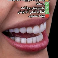جشنواره کامپوزیت دندان *باسفته بدون پیش پرداخت*