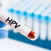 انجام آزمایش HPV با 50 درصد تخفیف