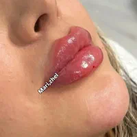 خدمات واموزش تخصصی ژل بوتاکس تتو چالگونه پرسینگ|خدمات آرایشگری و زیبایی|اهواز, کوی باهنر|دیوار