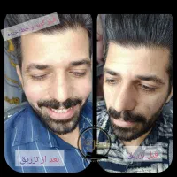 تزریق ژل،بوتاکس،آنزیم،پی آر پی، مزو ژل برای آقایان|خدمات آرایشگری و زیبایی|خرمشهر, |دیوار