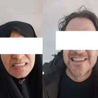 دندانسازی محلات(عقیق)