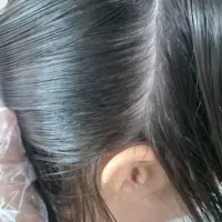 رفع ودرمان شپش سر