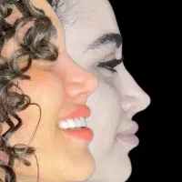 50%تخفیف ویژه عمل جراحی بینی بدون تامپون لیفت|خدمات آرایشگری و زیبایی|فردیس, طالقانی|دیوار