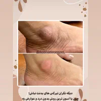 فرصت طلایی برای تزریق ژل و انواع فیلر بوتاکس|خدمات آرایشگری و زیبایی|بندرعباس, |دیوار