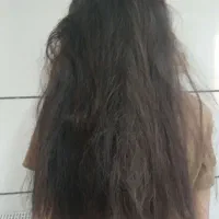 خدمات موخوره گیری تخصصی