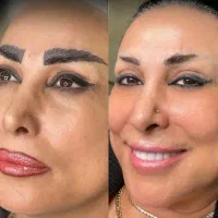 ریمو تتو صورت