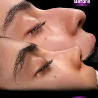 متخصص گوش حلق بینی