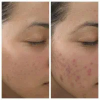 کرم وی ای پی اماراتی روشن کننده دائمی و ضدلک