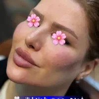 اموزش ژل و بوتاکس فقط با 3 میلیون با مدرک