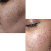 ژل لب 600|خدمات آرایشگری و زیبایی|ماهدشت, |دیوار