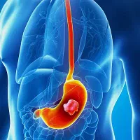 درمان مشکلات گوارشی