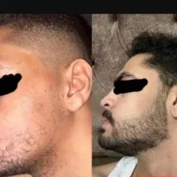 پسر بدون ریش کنسله