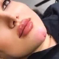 افتتاح کلینیک زیبایی دکتر سیفوری با ۱۰سال سابقه|خدمات آرایشگری و زیبایی|قرچک, مهدیه|دیوار