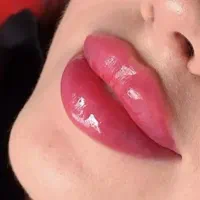 تزریق ژل
