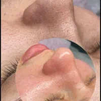 فیشیال صورت،با بهترین متریال و به روزترین دستگاه