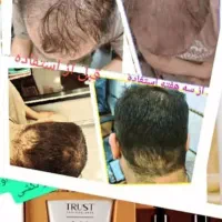 زیبایی و سلامتی پوست ومو|آرایشی، بهداشتی، درمانی|بابل, |دیوار