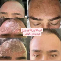 آلگاپیل،فیشال (خانمها و آقایان)