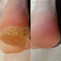 پدیکور پا
