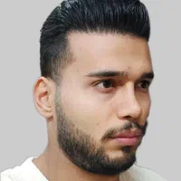 کاشت مووابرو با تخفیف درکلینیک تخصصی تبریز|خدمات آرایشگری و زیبایی|اردبیل, |دیوار