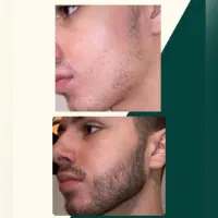 رشد مو|آرایشی، بهداشتی، درمانی|خمیر, |دیوار
