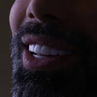 کامپوزیت دندان اقساطی فکی ۹میلیون