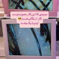 درمان تخصصی ریزش مو و رفع کم پشتی مو|خدمات آرایشگری و زیبایی|قم, صدوق|دیوار
