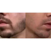 محلول های گیاهی رویش