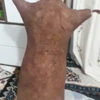 تعدای مشک|ظروف نگهدارنده، پلاستیکی، یکبارمصرف|کشکوئیه, |دیوار