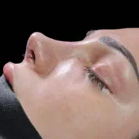 جراحی تخصصی بینی(فانتزی،نیمه فانتزی،طبیعی)