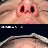 عمل جراحی بینی /لیفت صورت/پلک|خدمات آرایشگری و زیبایی|کرج, عظیمیه|دیوار