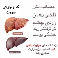 درمان تضمینی کبد چرب