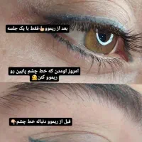 مدل برای ریموو تک جلسه ای خط چشم