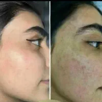 عید نزدیکه با ما بدرخشید یک پوست صاف صاف سفید