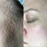 انجام کلیه خدمات پاکسازی پوست بصورت کاملا تخصصی|خدمات آرایشگری و زیبایی|سرپل ذهاب, |دیوار