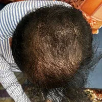 ترمیم مو نوین|خدمات آرایشگری و زیبایی|تهران, شهرک آزمایش|دیوار