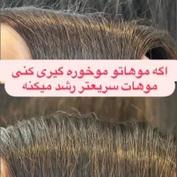موخوره گیری و پروتئین تراپی با پکیج الماس|خدمات آرایشگری و زیبایی|بومهن, |دیوار